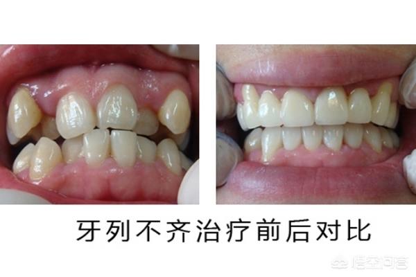浙江最新24小时牙医在线咨询方法分析(最方便真实的浙江有没有24小时牙医方法)